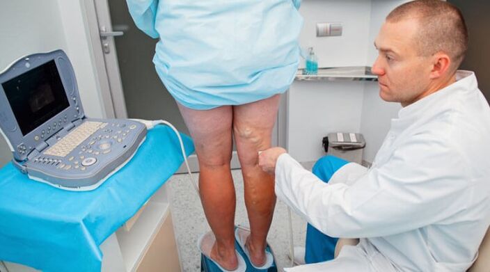 Diagnosis of varicose veins